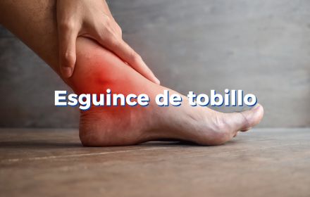 Esguince de tobillo