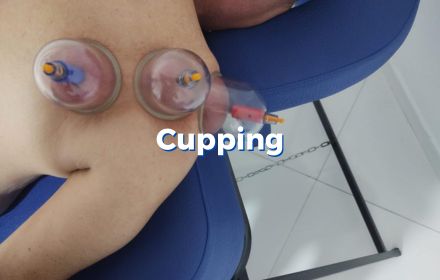 cupping
